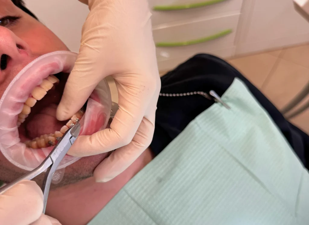 apparecchio dentale a foligno