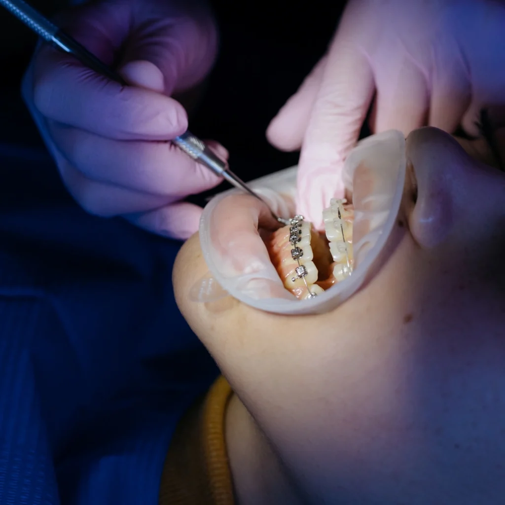 apparecchio dentale a foligno